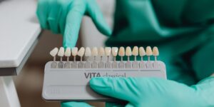 Four Tips to Effectively Eliminate Teeth Staining